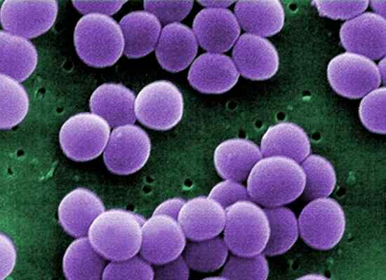 stafilococcus